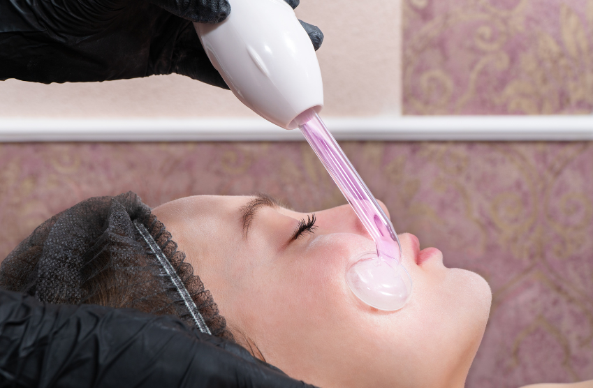 Tratamiento para Brote de Acné 60'